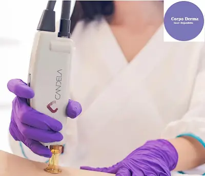 Corpo Derma Depilacion Laser Alejandrita — Peluquería en Santiago y Zaraíche